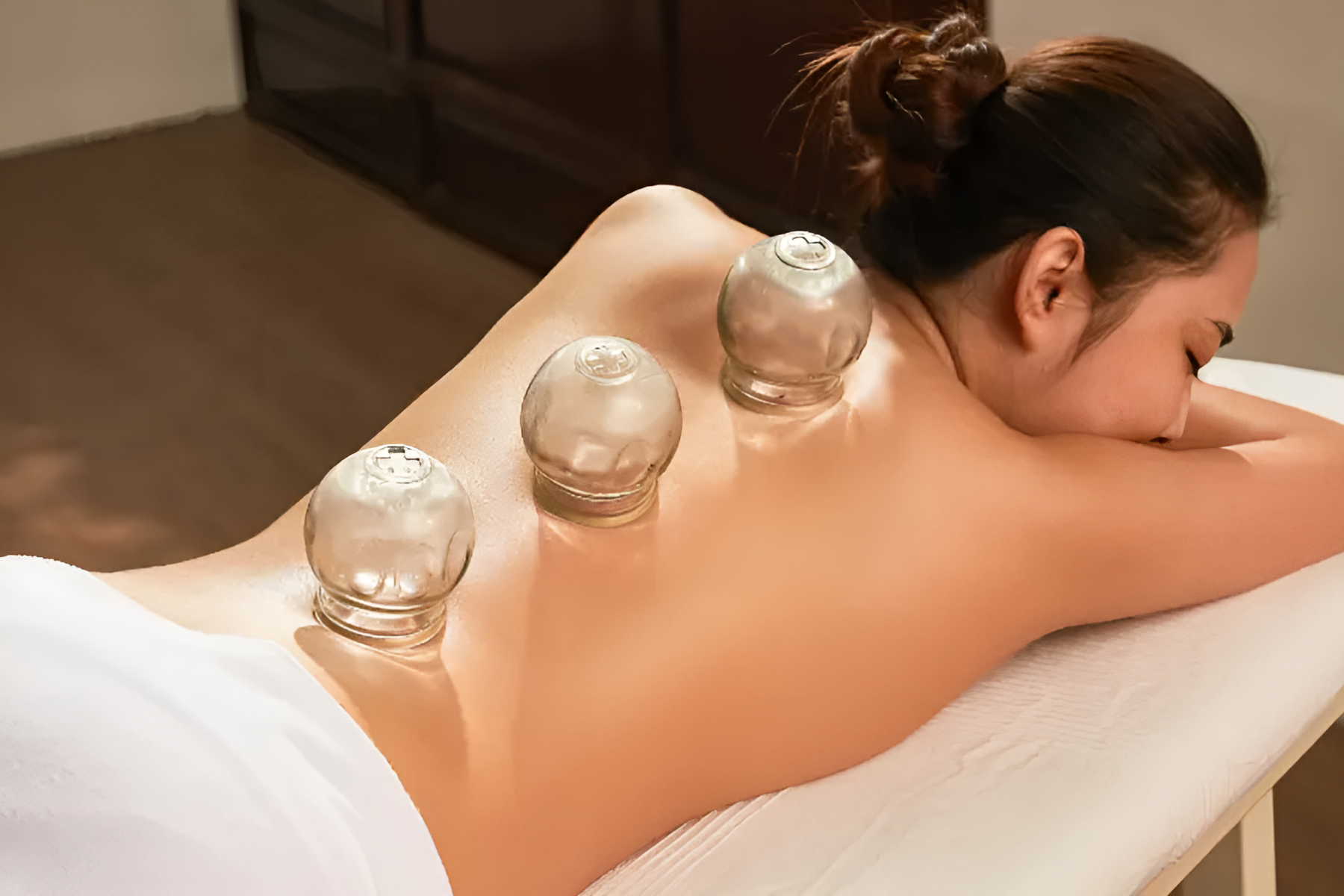Cupping